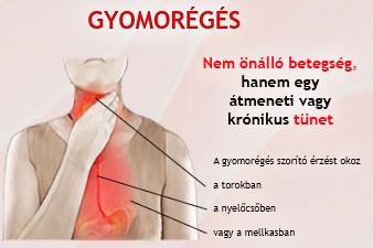 A gyomorégés okai, hajlamosító tényezői és kezelése